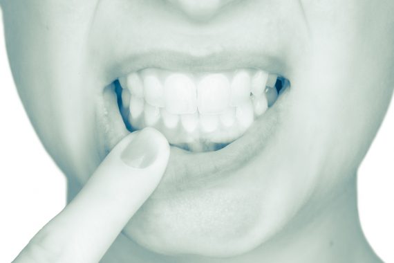 woman pointing to her gums